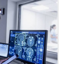 Écran affichant plusieurs images médicales du cerveau devant une salle d’examen vitrée.